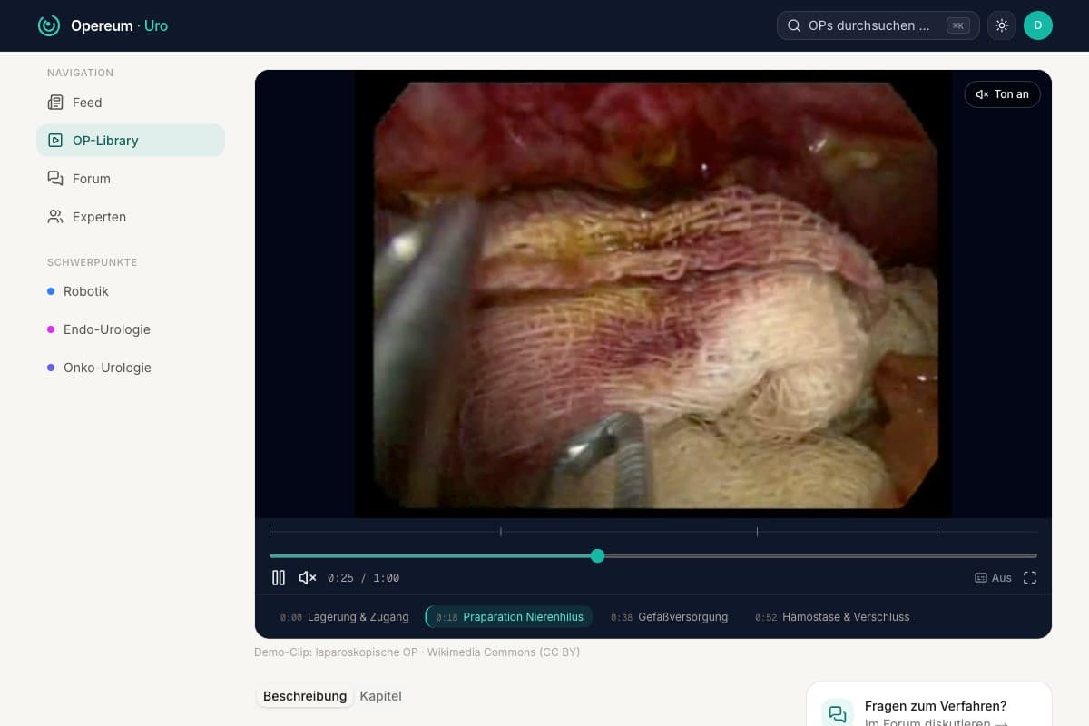 OP-Video-Player mit Kapitel-Markern und Untertiteln